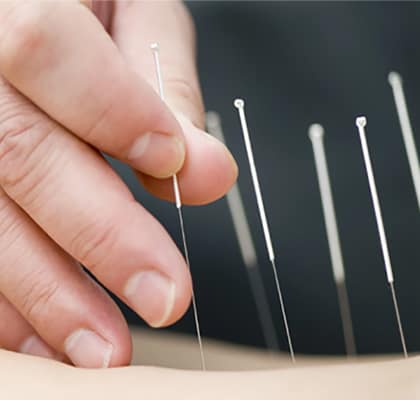 Tuina Massage Therapy in Edmonton